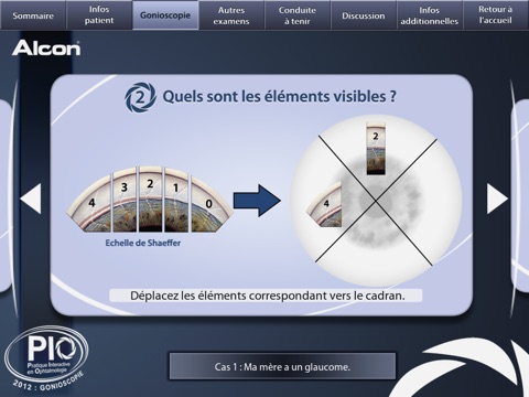 Alcon Gonioscopie screenshot 2