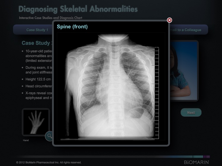 MPS Differential Diagnosis