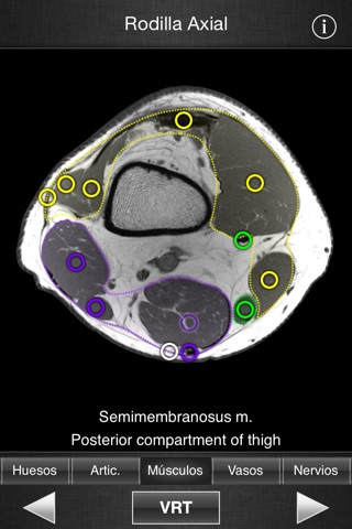 Monster Anatomy - Lower Limb screenshot 3