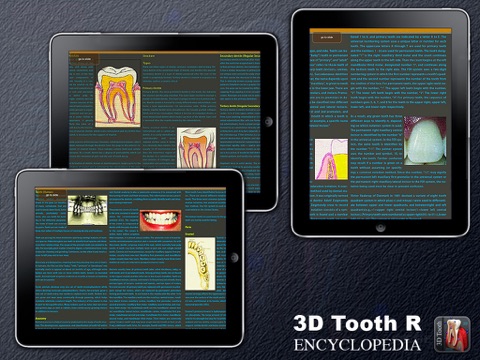 3D Tooth R screenshot 3