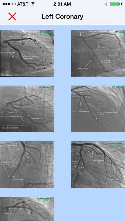 CathLab App screenshot-3