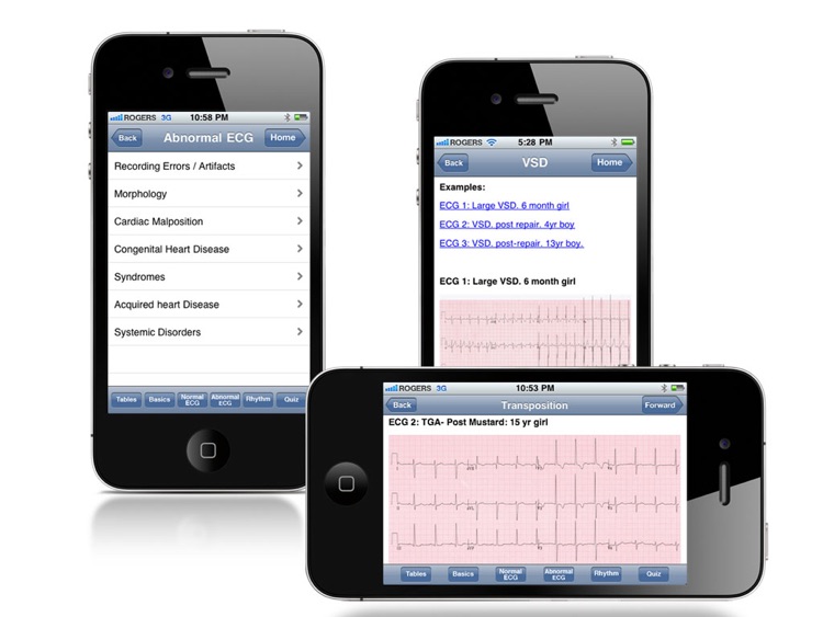 Paedcard ECG screenshot-3