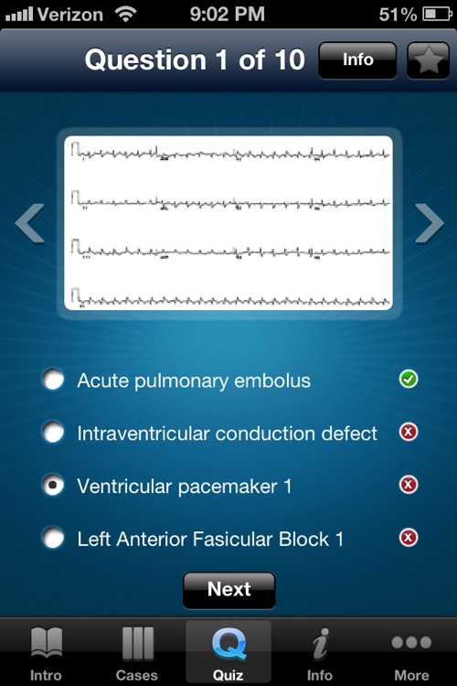 ECG - An Electrocardiogram Review for Healthcare Professionals screenshot-3