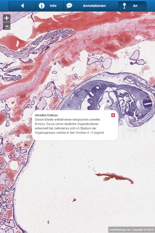 Smart Histology Lite screenshot 3