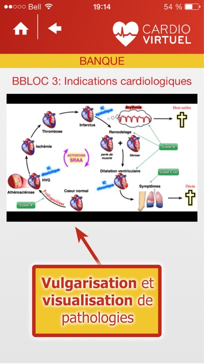 Cardio Virtuel présenté par des médecins spécialistes de l'Université Laval screenshot-4