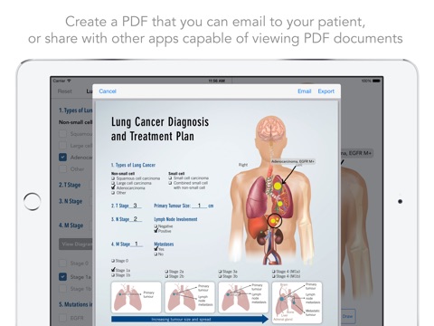 Lung Cancer Diagnostic App screenshot 2