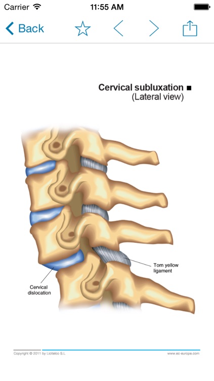 Miniatlas Musculoskeletal System screenshot-3