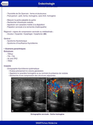 SMARTfiches Endocrinologieのおすすめ画像4