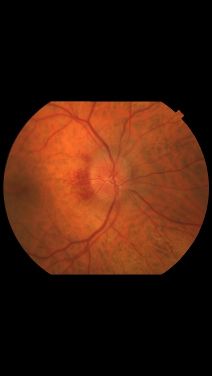 OphthoSim Companion