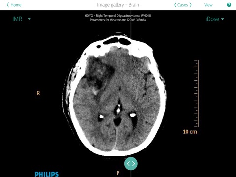 Philips IMR Review for Physicians screenshot 3
