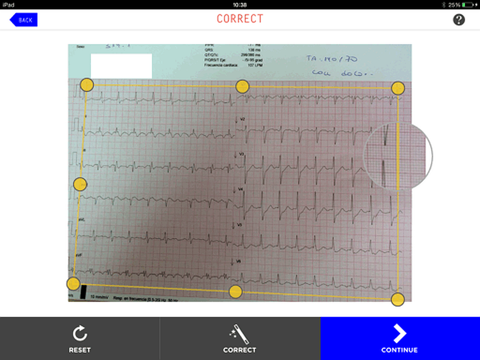 ECG Camera at App Store downloads and cost estimates and app analyse by ...