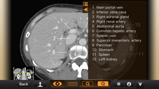 Interactive CT and MRI Anatomy Screenshot 3