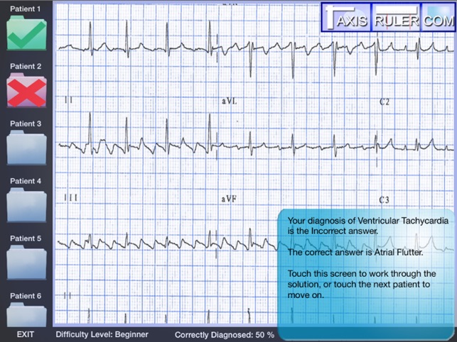 ECG Genius(圖1)-速報App