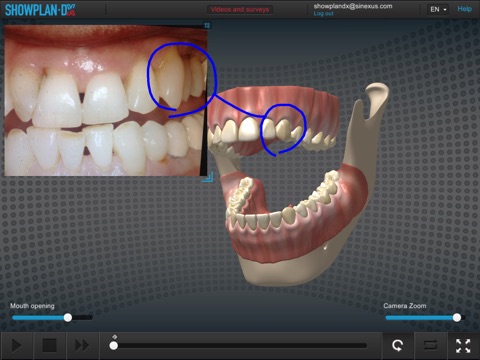 Showplan-DX - Dental screenshot 4