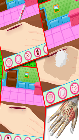 Hand Surgery Game(圖2)-速報App