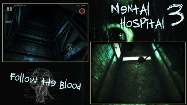 Mental Hospital III Lite(圖5)-速報App