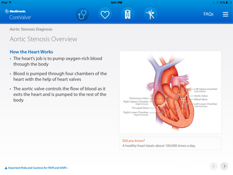 Aortic Stenosis Patient Journey screenshot 2