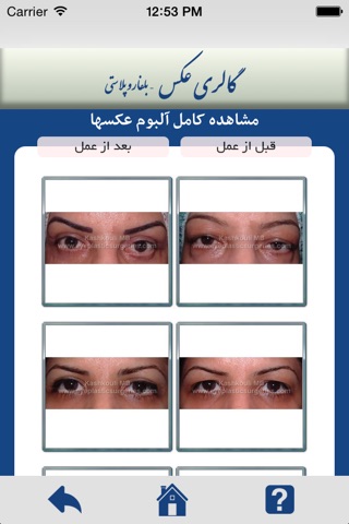 Eye Plastic Surgeries screenshot 3