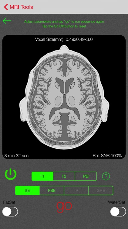 iRad MRI screenshot-3