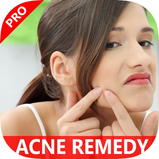 Learn How To Get Rid Of Pimples Fast - Best Natural ACNE Cure Treatment Right Now icon