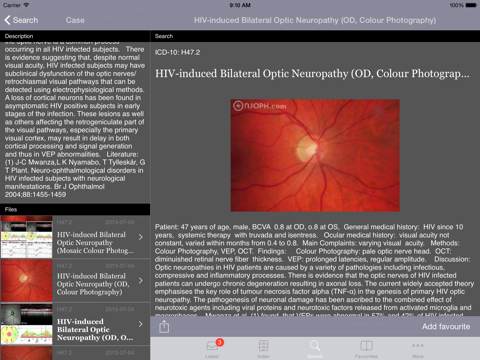 Atlas of Ophthalmology HD by Onjoph screenshot 3