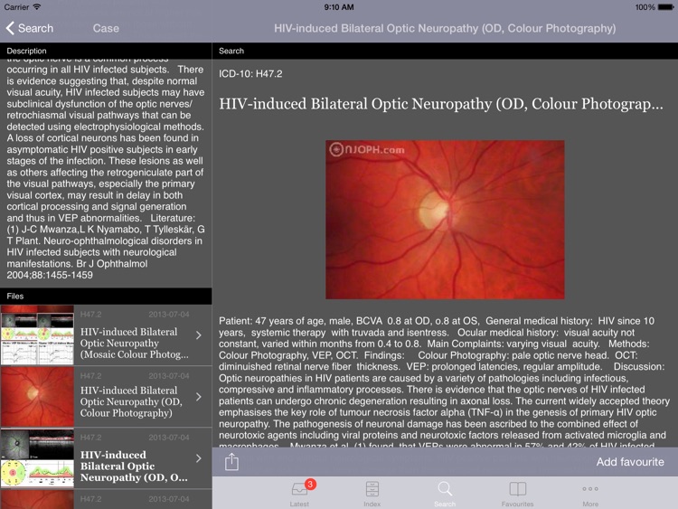 Atlas of Ophthalmology HD by Onjoph