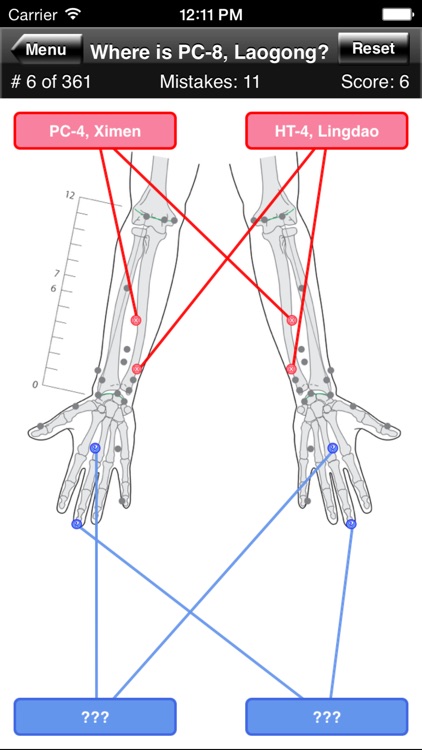 Acupuncture Points Body Quiz