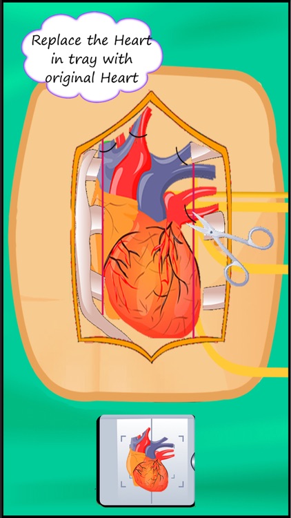 Heart Surgery : Free Virtual Heart Transplanet Games For Kids screenshot-3