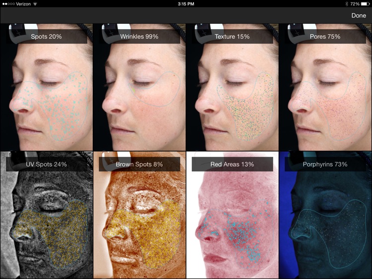 VISIA® screenshot-3