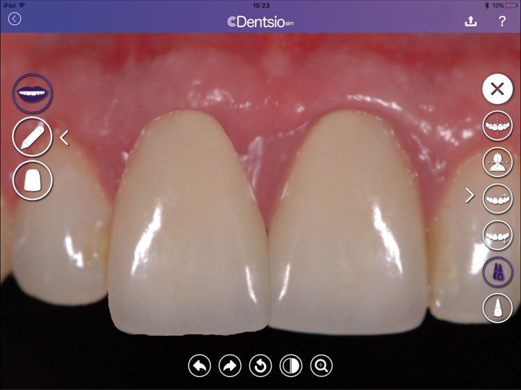 DentsioSim