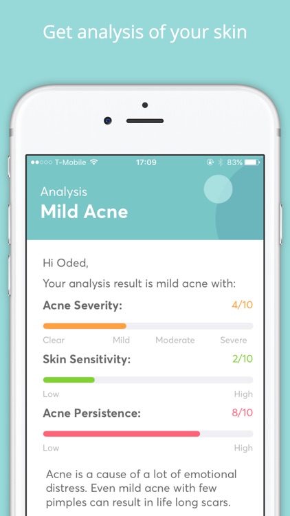 MDacne - What is the best treatment for Acne?