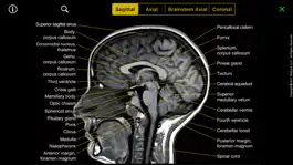 Game screenshot NeuroRad Mini apk