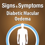 Signs  Symptoms Diabetic Malucar Oedema