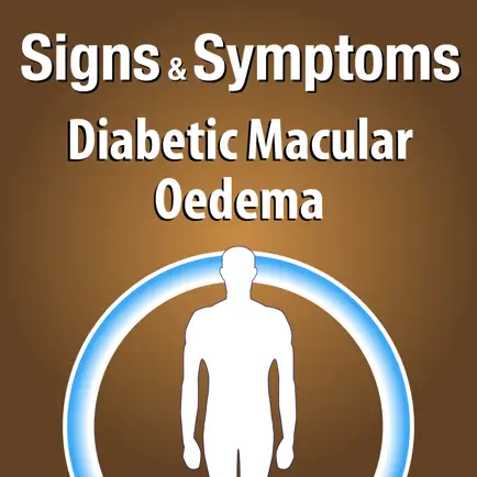 Signs & Symptoms Diabetic Malucar Oedema Читы