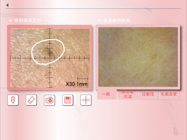 Skin Analyser(圖3)-速報App