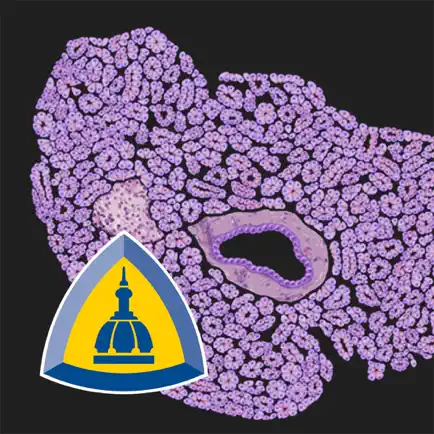 Johns Hopkins Atlas of Pancreatic Pathology Cheats
