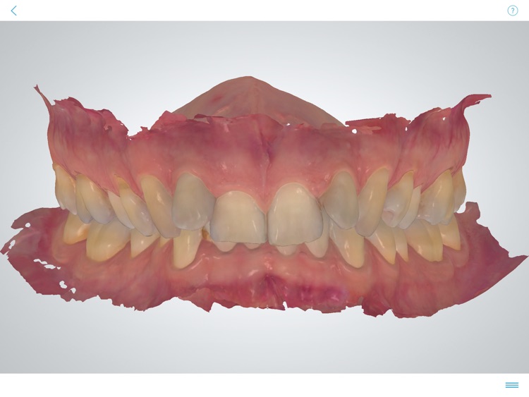 3Shape TRIOS® ortho clinics screenshot-3