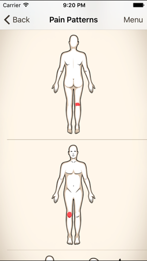 Clinical Pattern Recognition: Knee pain(圖2)-速報App