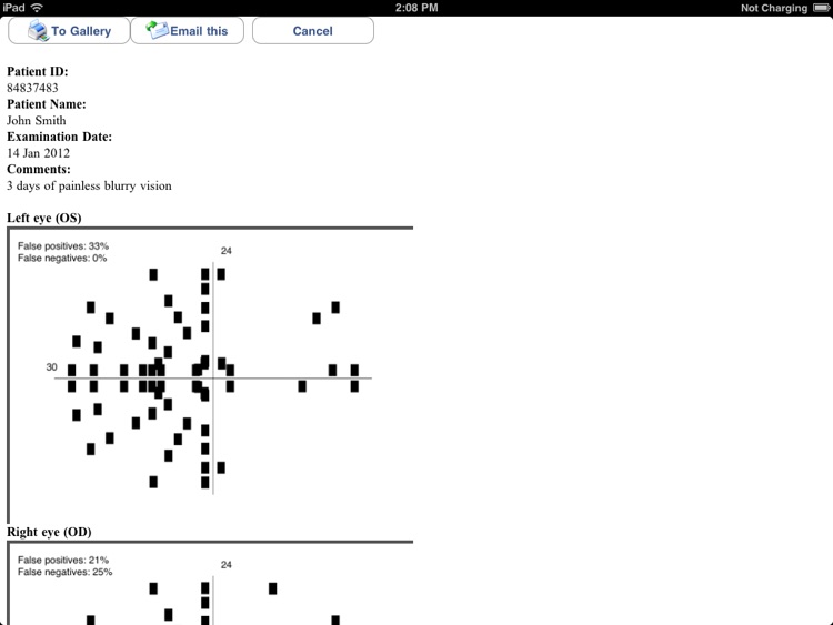 visualFields easy