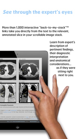 Thoracic Imaging - A Primer for Physicians(圖4)-速報App