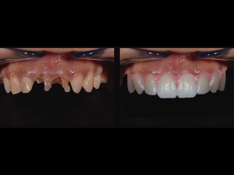 DentsioSim