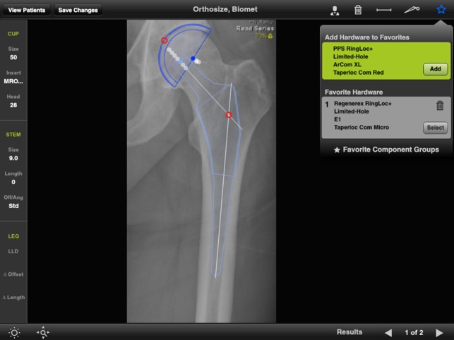 Biomet Orthosize Templating(圖4)-速報App