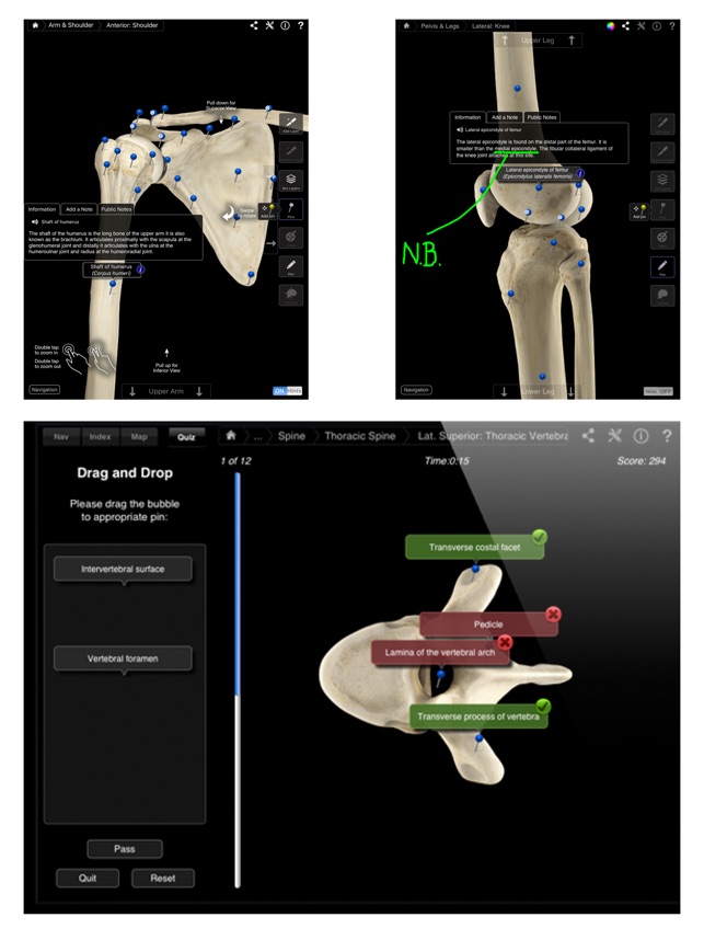 Skeleton System Pro III(圖3)-速報App