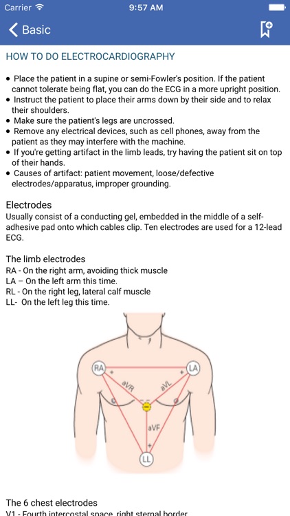 Electrocardiography (ECG) Guide