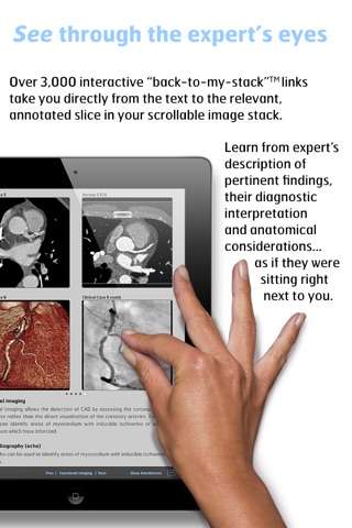 Thoracic Imaging Fundamentals screenshot 4