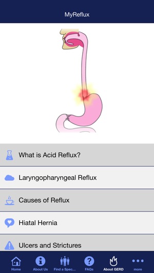 MyReflux(圖4)-速報App