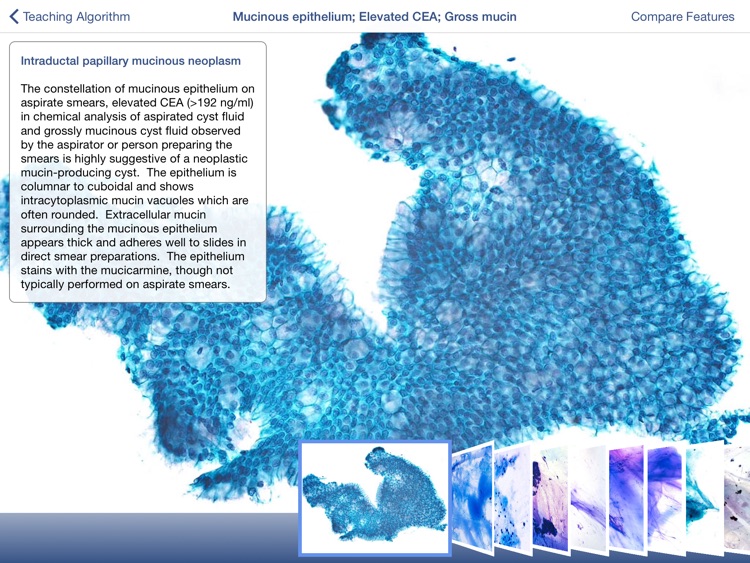 Johns Hopkins Atlas of Pancreatic Cytopathology