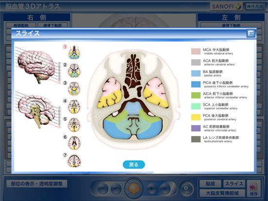 脳血管3Dアトラスのおすすめ画像5