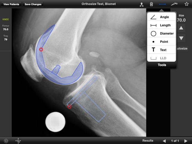 Biomet Orthosize Templating(圖2)-速報App