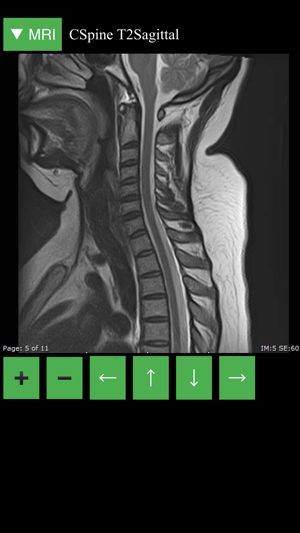 MRI Viewer(圖3)-速報App